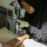 Program Hapus Tato Gratis, Mulai Wanita Hingga Lansia Serbu Klinik