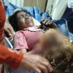 Nenek Di Banyuwangi Terbakar Saat Kebakaran Rumah, Kini Jalani Perawatan