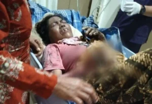 Nenek di Banyuwangi Alami Luka Serius, Tersambar Api Saat Kebakaran Rumah