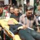 Lihat bekas ciuman, pria di tegal tega lukai wajah mantan